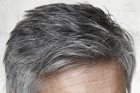 Image result for White hair
